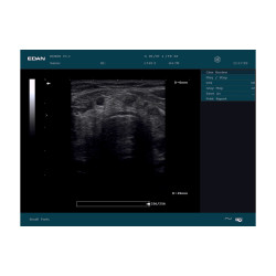Echographe portable Edan DUS60 avec 2 sonde