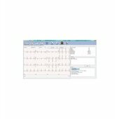 Edan SE 1010 LOGICIEL SE-1515