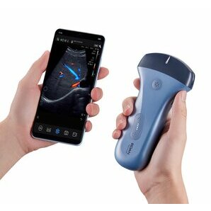 Échographe portable couleur Edan Nano