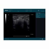 Echographe portable Edan DUS60 (sonde au choix) Echographe portable Edan DUS60